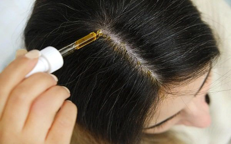 استفاده مؤثر داروی ماینوکسیدیل